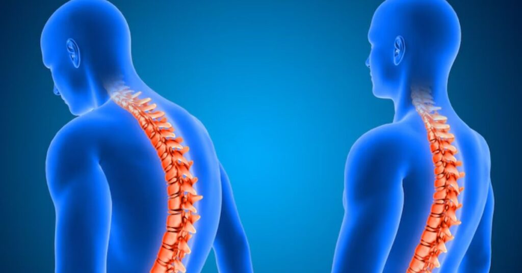 Spinal Problems treatment in Indore, spine doctor in Indore